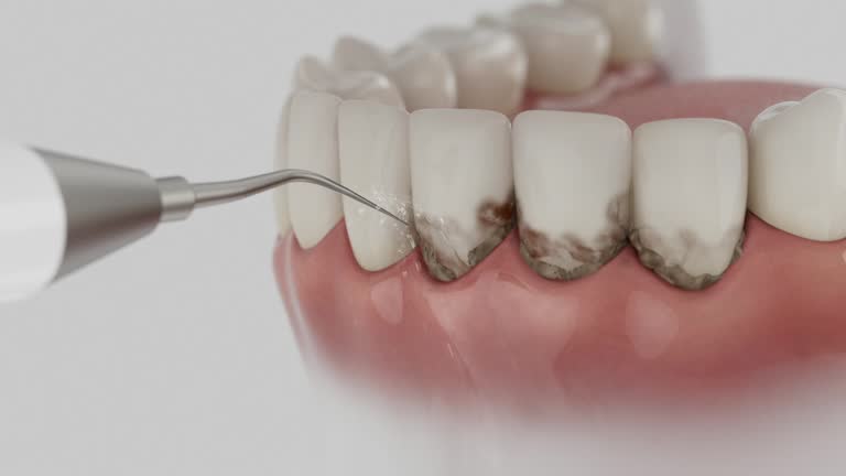 Reliable Tooth Extraction contractor in Chesapeake, VA by Smile Center Dentistry